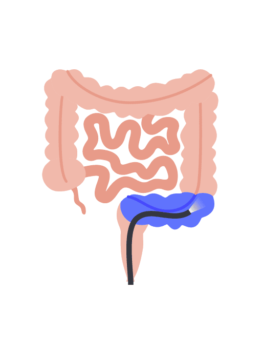 sigmoidoscopy icon